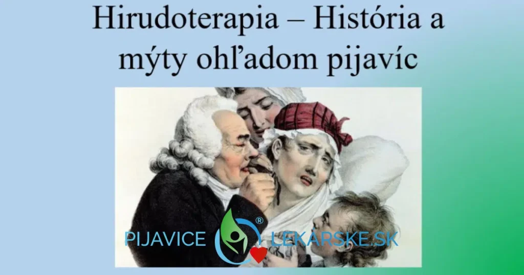 História a mýty o pijaviciach je dôležitá súčasť Hirudoterapie aj dnes