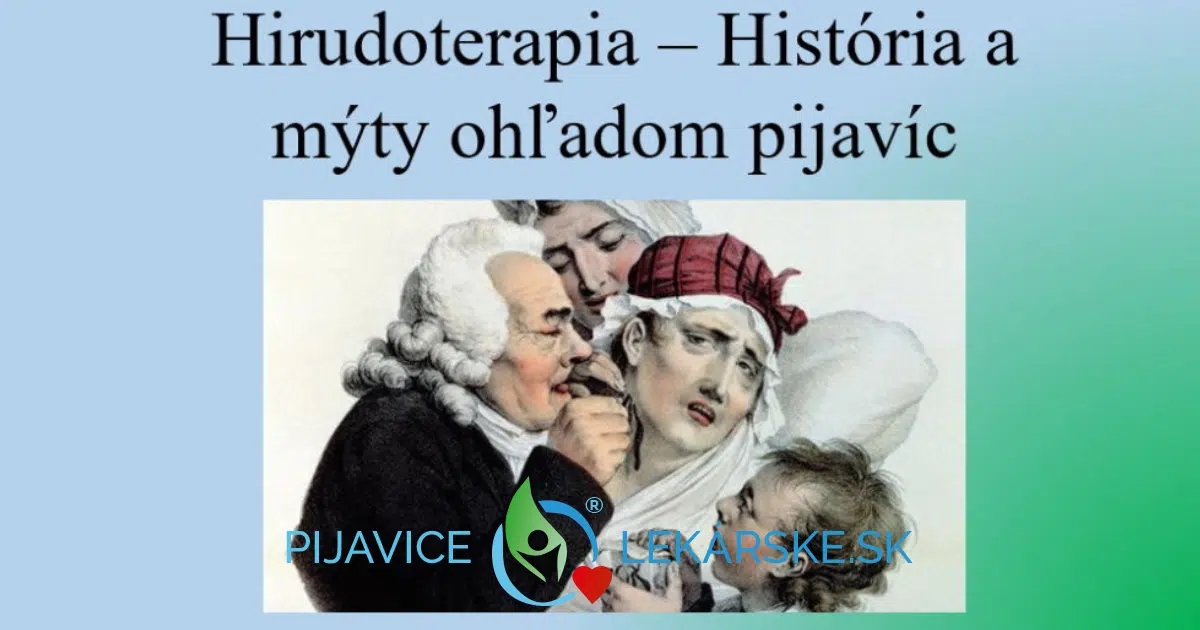 Hirudoterapia – História a mýty ohľadom pijavíc